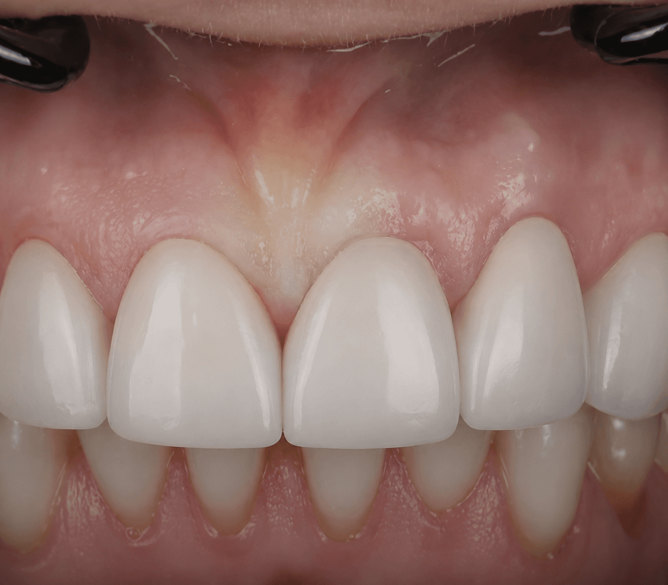 Cosmetic Dentistry at Dentin Family Dentistry Vaughan