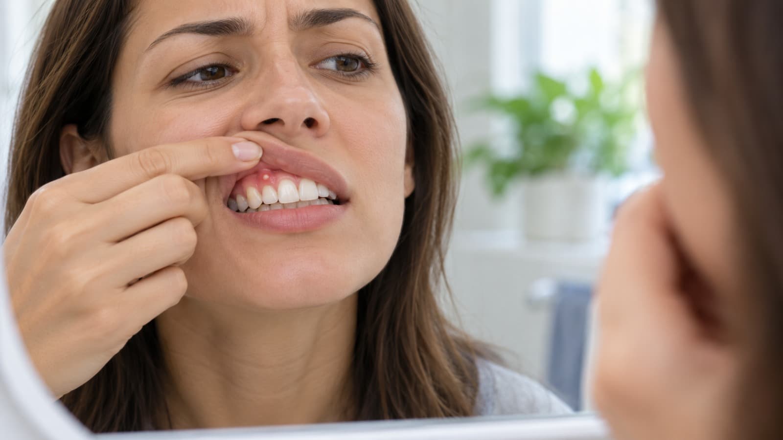 Woman looking in the mirror and lifting her lip to check a pimple-like bump on the gum above her upper front teeth
